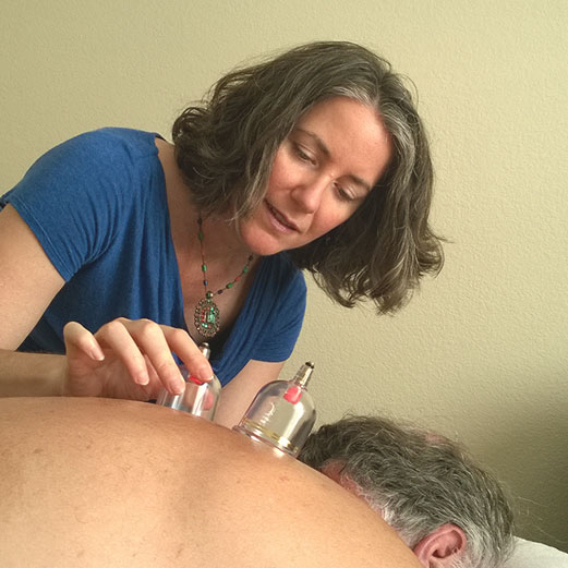Cupping & Gua Sha